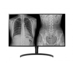LG 32" 32HL512D-B Diagnoze TFT 2xDP, HDMI, USB 3.0
