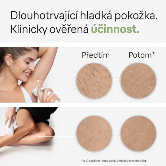 "Braun Silk-expert Pro 3 PL3020 IPL balts-sudrabs